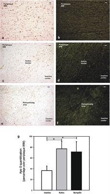 Expression Pattern of Myelin-Related Apolipoprotein D in Human Multiple Sclerosis Lesions